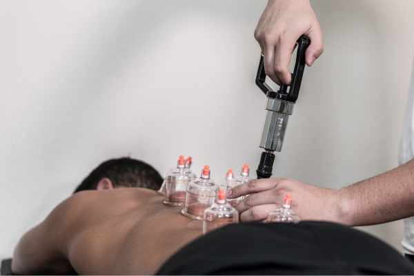 Cupping massage Blaricum - Laren - Hilversum